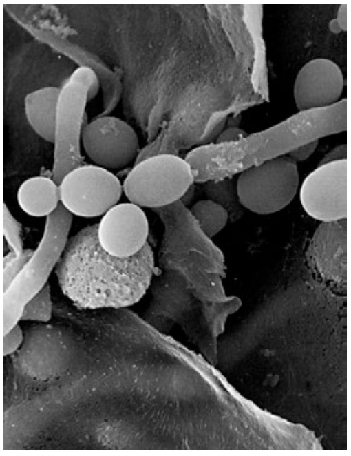 ¿Preparar o no a los especímenes biológicos para estudiarlos con el microscopio electrónico de barrido?